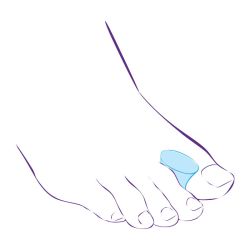 СТ-31 (L) Межпальцевая перегородка